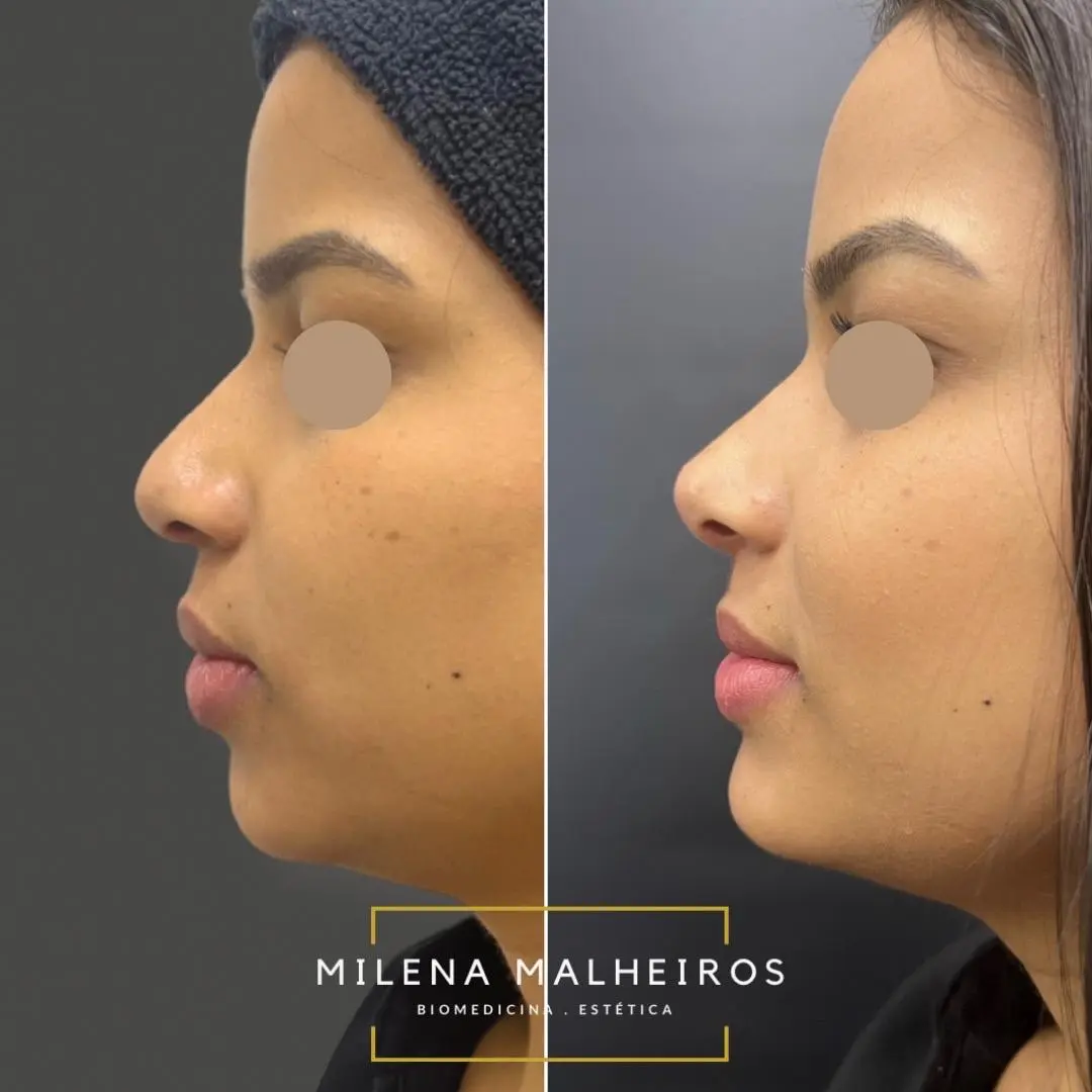 Tratamentos faciais — segunda imagem fornecida pela Libert Beleza