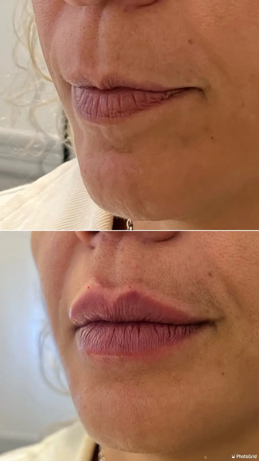 Tratamentos faciais — terceira imagem fornecida pela Libert Beleza