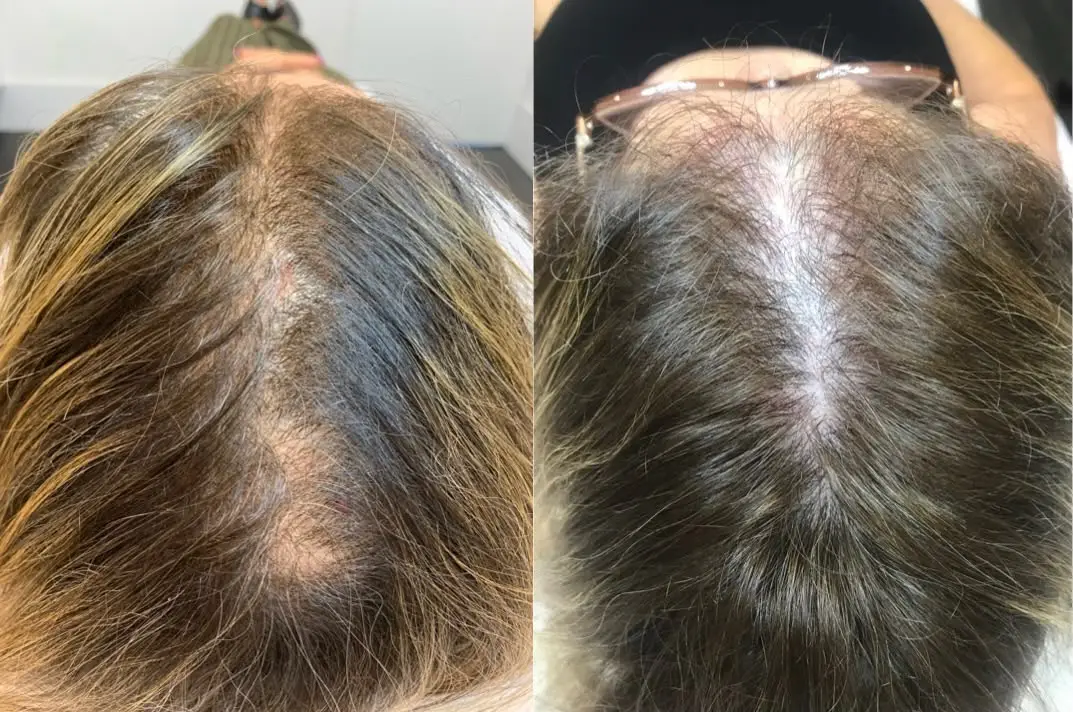 Tricologia — segunda imagem fornecida pela Libert Beleza